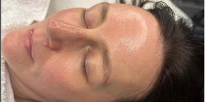 Close-up of a person's face with closed eyes, showing their skin after a bespoke facial treatment.