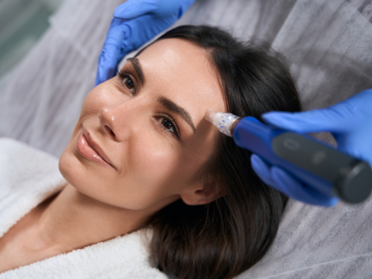 Microneedling vs Dermaplaning: Which Treatment is Best for Your Skin ...